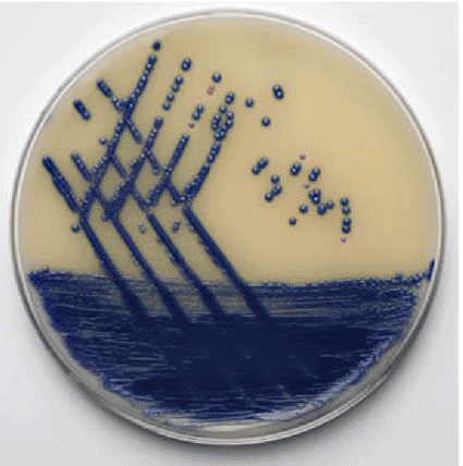 Image: Distinctive denim-blue colonies of MRSA on chromogenic agar (photo courtesy Oxoid). Image: Distinctive denim-blue colonies of MRSA on chromogenic agar (photo courtesy Oxoid).